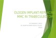 Ologen Implant-Replacing Mmc In Trabeculectomy