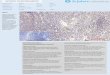 Immunohistochemistry Antibody Validation Report for Anti-Glut1 Antibody (STJ93293)