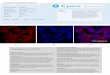 Immunofluorescence Antibody Validation Report for Anti-CK16 Antibody (STJ96958)