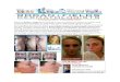 Rodan + Fields Product Guide Before and After Pictures
