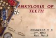 ankylosis of teeth