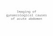 Gynacological causes of acute abdomen