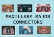 Maxillary major connectors