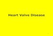 1 Heart Valve Disease. 2 3 4 5 Valvular heart disease Valves make sure blood flows in a forward direction –no backward leakage Tricuspid and mitral