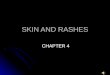 SKIN AND RASHES CHAPTER 4