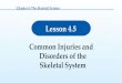 Lesson 4.5 Common Injuries and Disorders of the Skeletal System Chapter 4: The Skeletal System
