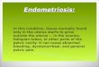Endometriosis:  In this condition, tissue normally found only in the uterus starts to grow outside the uterus — in the ovaries, fallopian tubes, or other