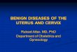 BENIGN DISEASES OF THE UTERUS AND CERVIX Rukset Attar, MD, PhD Department of Obstetrics and Gynecology