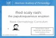 Red scaly rash the papulosquamous eruption