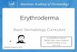 Erythroderma dermatology 2017