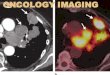 Oncology imaging