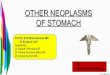 other neoplasms of stomach