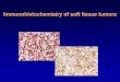 Immunohistochemistry of soft tissue tumors - epathologiesepathologies.com/sem/tm05/IHC_SA_Bey05.pdf · Immunohistochemistry • Future of IHC is promising ... Ancient schwannoma 