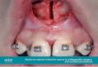 DIPLOMA DE ENDODONCIA ONLINE - EACMFSeacmfs.org/wp-content/uploads/2016/02/HANDS-ON-IN-ORTHOGNATH… · diploma de endodoncia online hands-on cadaver intensive course in orthognathic