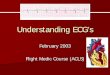 Understanding ECG’s - PHSI Describe the basic approach to interpretation of ECG strips Explain the five steps used in interpretation of ECG strips Explain how to calculate heart