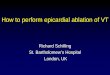 How to perform epicardial ablation of VT - Arrhythmia · PDF fileRichard Schilling St. Bartholomew’s Hospital ... • Useful for identification of target vessel. Ethanol ablation