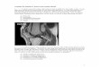 Review Questions Lower Extremity · PDF file · 2017-04-16LOWER EXTREMITY PRACTICE QUESTIONS 1. ... to the use of the muscle that courses between the sesamoid bones. This muscle 