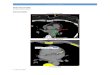 CT Calcium score - Austin Radiological Association Tomography... · Web viewSelect “save word document and images as DICOM series 