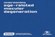 Understanding age-related macular degeneration - · PDF fileAge-related macular degeneration ... cone cells function best in bright light levels and allow ... arrange for an eye test