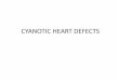 CYANOTIC HEART DEFECTS -   the pathophysiology, and consequences of cyanotic heart defects with key examples 3. ... • 10% of CHD • Anatomy