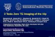 3 Tesla Zero TE Imaging of the Hip · PDF file3 Tesla Zero TE Imaging of the Hip ... standard MR sequences, the 3D models cannot ©2016 MFMER ... • Non-rescaled axial ZTE