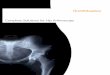 Complete Solutions for Hip Arthroscopy - Smith & Nephew · PDF fileComplete Solutions for Hip Arthroscopy. 2 ... †DYONICS Blades and Burrs are used in conjunction with ... • A