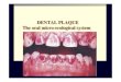 DENTAL PLAQUE The oral micro-ecological systemsemmelweis.hu/.../LOCAL-PLAQUE-and-PLAQUE-RETENTIVE-FACT… · The non-specific theory in microbial etiology of inflammatory ... are