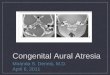 Congenital Aural Atresia - UCLA Health - Los Angeles, CA · PDF file · 2012-03-22Congenital Aural Atresia. Miranda S. Dennis, M.D. April 6, 2011. Embryology. External Auditory Canal