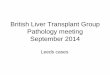 British Liver Transplant Group Pathology meeting September · PDF file · 2014-10-07British Liver Transplant Group Pathology meeting ... Liver transplant for HCV cirrhosis with HCC