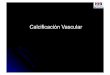 Calcificación Vascular - nefrohospbritanico.org.arnefrohospbritanico.org.ar/clases/CALCIFICACION_VASCULAR.pdf · Theories Regarding Molecular Mechanism for Vascular Calcification