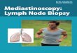 Mediastinoscopy: Lymph Node Biopsy (PDF) · PDF fileWhat You Will Learn This product will help you understand more about mediastinoscopy and what to expect with the procedure. If you