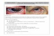 2013-2014 Clinical Ophthalmology By : Saif S. Zaina · PDF filePseudo-membrane: most of bacterial ... Is it a concomitant or incomitant squint? ... Esotropia: convergent Exotropia: