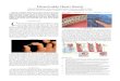 Dissolvable Heart Stents - University of Rhode · PDF fileincrease blood flow through the artery by artery disease and heart attack in the United ... Results for dissolvable heart
