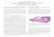Esophageal papillomatosis complicated by squamous · PDF fileEsophageal papillomatosis complicated by squamous cell carcinoma ... the esophagus, ... Esophageal papillomatosis complicated