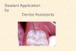 Sealant Application by Dental Assistants - Dent-Ed-Onlinedent-ed-online.com/multimedia/sealants/faculty_summary.pdf · to dental assistants placing sealants, ... (coronal polishing