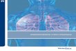 understanding chest drainage - Teleflex booklet is designed to aid in the understanding of chest drainage. ... air sacs, called alveoli. The ... should never completely collapse for