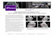 Rehabilitation Guidelines for Knee Multi-ligament … Guidelines for Knee Multi-ligament Repair/Reconstruction 333 38th St. New York, NY 10016 (646) 501 7047 newyorkortho.com! the