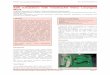 Case Report Safe Extubation with Totaltrack® Video ...aijournals.com/journals/aan/pdf/Vol1Issue1/2_CR_V1N1.pdf · Pre-existing airway concerns, such as difficult mask ventilation,