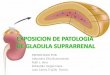 EXPOSICION DE PATOLOGIA DE GLADULA … · •GLANDULAS SUPRARRENALES Cambio hialino de Crooke (mas frecuente, por elevadas concentraciones de glucocorticoides), el citoplasma granular