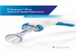 Pulsavac Plus Wound Debridement - Zimmer Plus with Battery The Pulsavac Plus combines convenience and power for smooth, efficient irrigation and debridement. The external battery pack