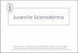 Juvenile Scleroderma - UNESP · Juvenile Scleroderma ... ANA in serum and CSF • Clinical remission, MRI stabilisation with MTX therapy . ... • Laser Doppler flowmetry