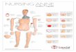 NURSING ANNE - Welcome to Laerdal Medical – … Infected Colostomy 300-02150 Belly Plate Assembly, Hospital 3-Hole 300-04950 Stoma, Soft Style with Thru Hole 380475 Pin Pelvis 325-00250