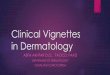 Clinical Vignettes - Florida Osteopathic Medical Association · who are fair and burn or tan easily versus individuals ... Industrial exposure ... Pathophysiology is multifactorial
