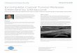 Gronseth Carpal Tunnel Case Study M1290 0218 Rev … RIGHT . Title: Gronseth_Carpal Tunnel Case Study_M1290 0218 Rev A(MG5).indd Created Date: 2/20/2018 3:07:04 PM 