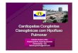 Cardiopatias Congênitas Cianogênicas com Hipofluxo …sociedades.cardiol.br/sc/profissional/acervo/palestras/24-09-2006/... · Tetralogia de Fallot • Embrio: EPV + CIV • CIV