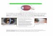 1. Introduction to Anatomy of the Eye and its Adnexa - cu · 1. Introduction to Anatomy of the Eye and its Adnexa Let us imagine we are traveling with a ray of light into the eye