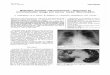 Metastatic prostatic adenocarcinoma -diagnosed by bronchoalveolar ...erj.ersjournals.com/content/erj/4/10/1296.full.pdf · Eur Resplr J. 1991, 4, 1296-1298 CASE REPORT Metastatic