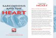 SARCOIDOSIS AND THE · only in late-stage sarcoidosis of the heart ... have had skipped heart beats, felt your heart racing, have passed out or have evidence of heart failure 