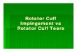 I-Rotator Cuff Impingement vs Rotator Cuff Tear.ppt is Rotator Cuff Impingement? ... Microsoft PowerPoint - I-Rotator Cuff Impingement vs Rotator Cuff Tear.ppt [Compatibility Mode]