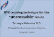 BTK crossing technique for the uncrossableâ€‌ lesion crossing technique for the â€œuncrossableâ€‌ lesion Tatsuya Nakama MD. Miyazaki Medical Association Hospital, Miyazaki,